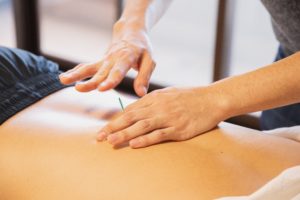 aiguille - acupuncture - massage - dos - France massage - masseur